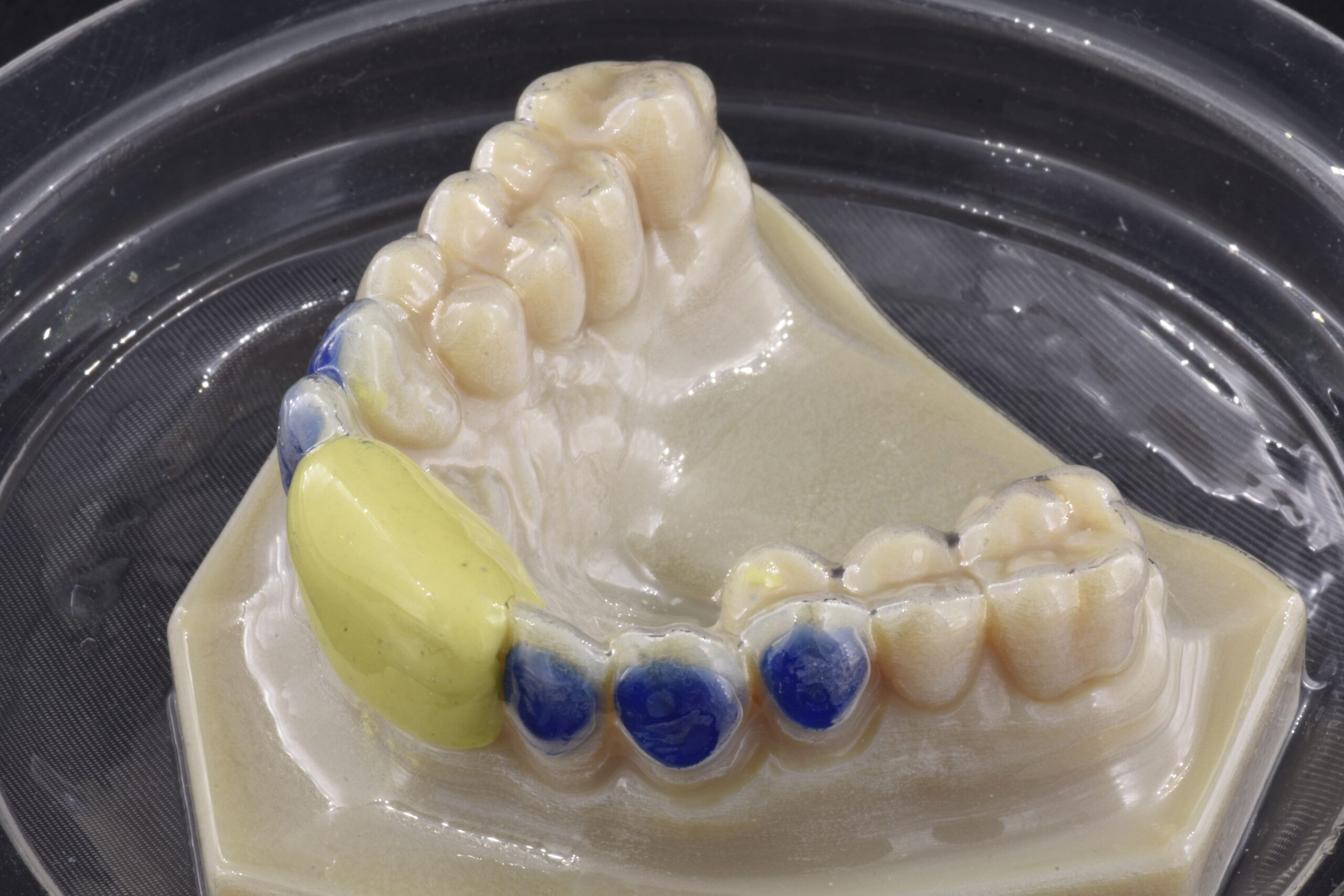 Mascherina sbiancamento