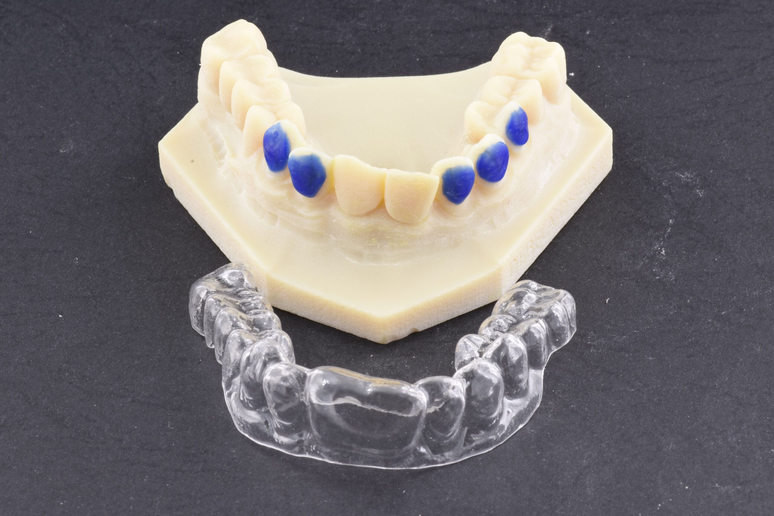 Mascherina sbiancamento