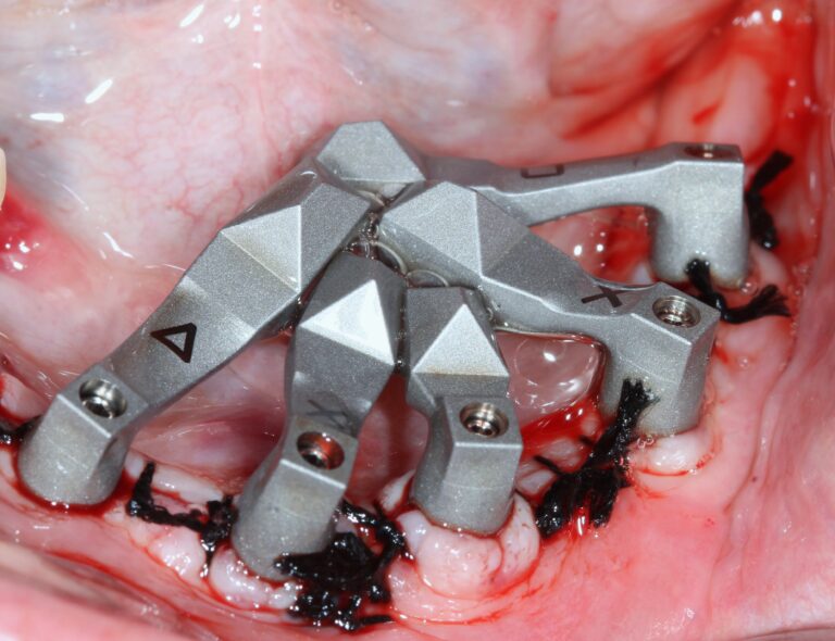 Scanlogiq Dentalstyle