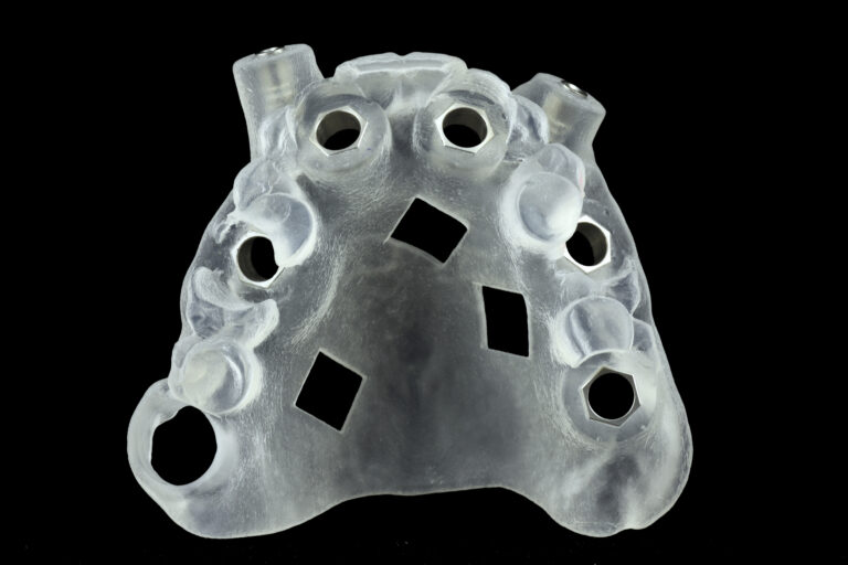 CHIRURGIA GUIDATA DENTALSTYLE